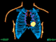 Mastering Auscultation